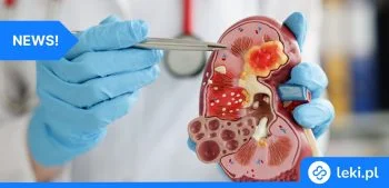 Ilustracja poradnika Jak ciągłe monitorowanie glikemii umożliwia wcześniejsze wykrycie cukrzycy po przeszczepie nerki?