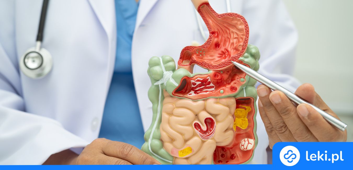 Jak rozpoznać zakażenie Helicobacter pylori i dlaczego probiotyki mogą pomóc w leczeniu?