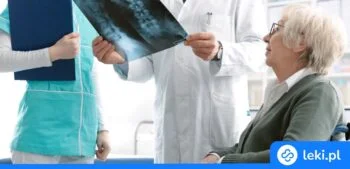 Ilustracja poradnika Kiedy kości słabną po cichu – co warto wiedzieć o osteoporozie