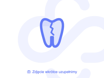 Zdjęcie produktu Fluormex, żel, 12,5 mg/g